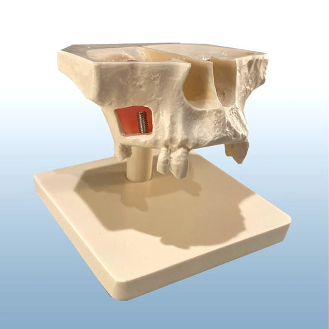 Dental Sinus Lift Surgery Model Surgical Implantation Practice Training