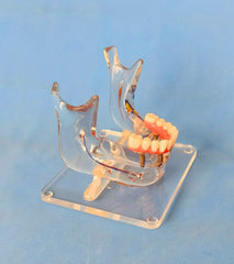 dental sinuses veneer implant model 