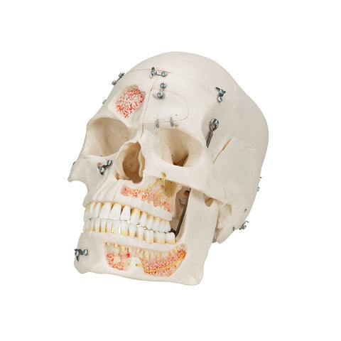 Human Skull Model