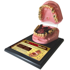Smokeless Tobacco Mouth Model
