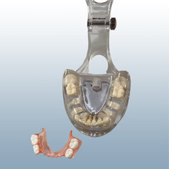 orthodontic space maintenance pre-eruption model 