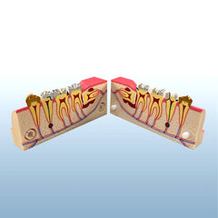 Endodontic Pulp Teeth Disease Pathology Model