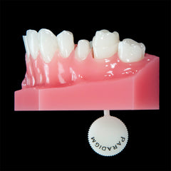 Dental Prepped Teeth Crown Bridge With Removable Dies