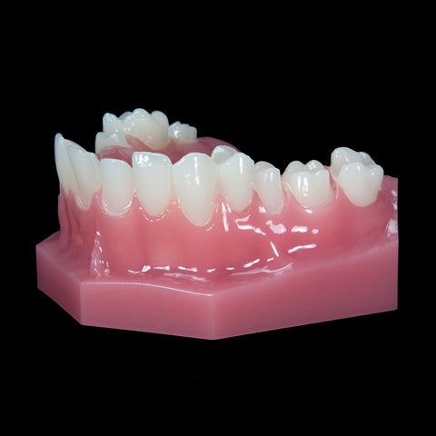 Dental Prepped Teeth Crown Bridge With Removable Dies