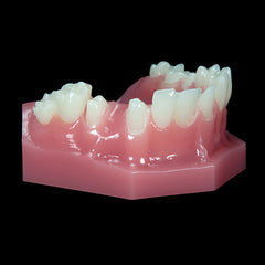 Dental Prepped Teeth Crown Bridge 