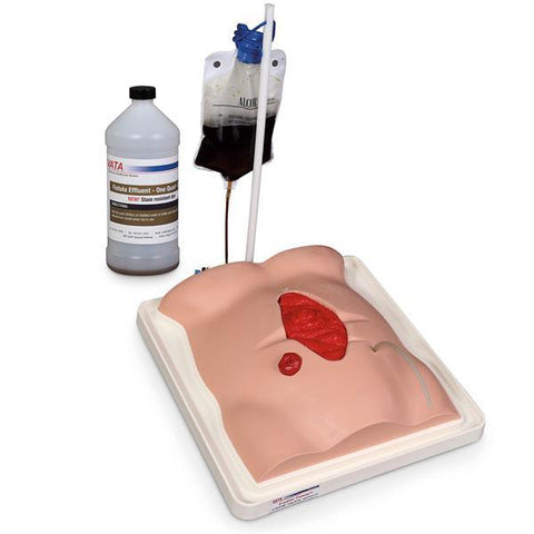 Abdominal Open Wound Draining Fistula Model