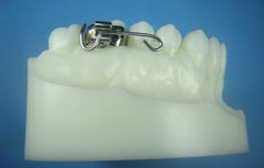 Anterior Bite Plate Retainer Orthodontic Model