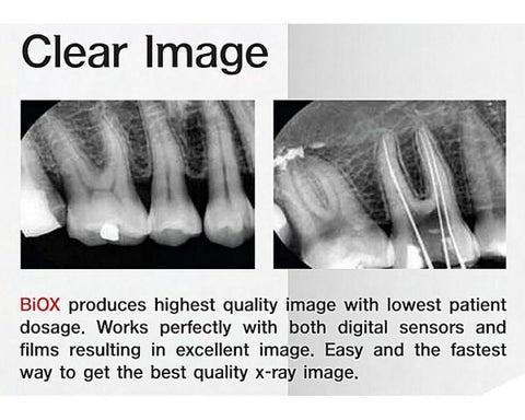 Biox Dental X-Ray Camera Portable Handheld Wireless Ergonomic Deluxe