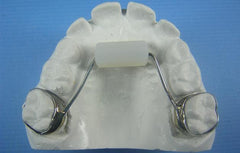 Bluegrass Retainer Orthodontic appliance Model