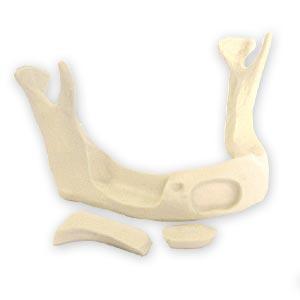 dental bone drilling model