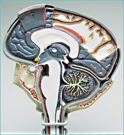 Brain Sagittal Cut 2-Sided View: Median Plane & Lateral Ventricle