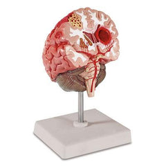 human brain anatomical model