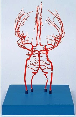 Brain Arteries Model