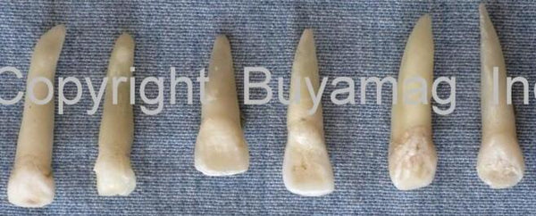 canine real human teeth