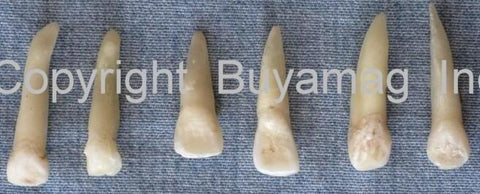 canine real human teeth