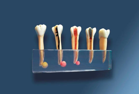 Dental Diseases Pathologies & Treatment Model