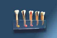 Dental Diseases Pathologies & Treatment Model