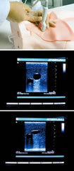 Central Venous Cannulation Ultrasound Guided CVC Training Simulator