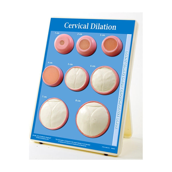 Cervical Dilation Display Model