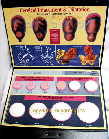 Cervical Effacement Dilation Display model