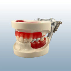 orthodontic child pedo epoxy resin model
