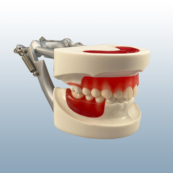 child pedo epoxy resin orthodontic model