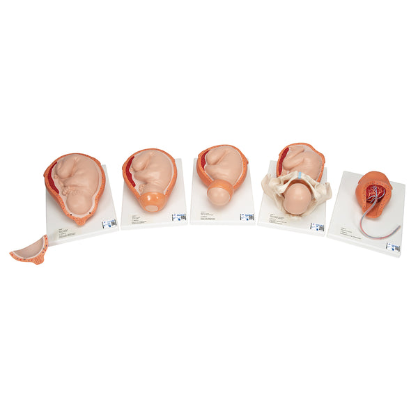 Childbirth cervical dilation model 5 Stages