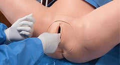 Optional Postpartum  Episiotomy