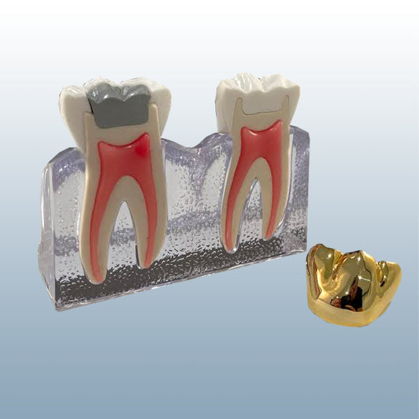 cracked tooth model