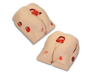 Decubitus bed sores Ulcer Wound model 