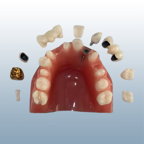 dental cosmetic variety restoration