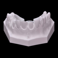 dental-crown-bridge-model