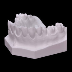 dental-crown-bridge-model