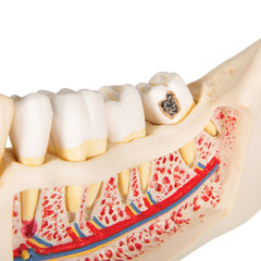 oral disease model