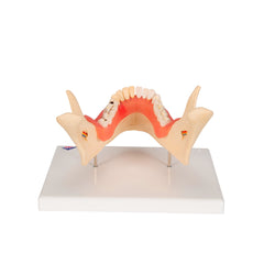 periodontal disease education model