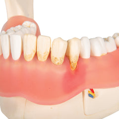 dental gum inflamation model