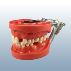 Edentulous Dental Model