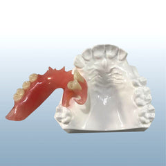 dental flexible partial model