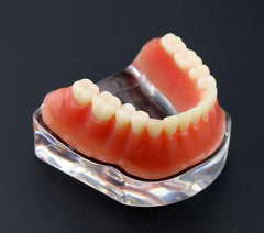 Dental Implant Model with 4 Implants Overdenture