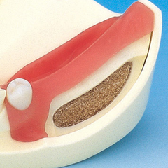 implant drilling practice model