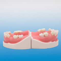 dental implants practice model