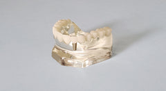 Dental Patient Education Presentation Model 3 Bridges 1 Crown 