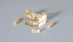 Dental Patient Education Presentation Model 3 Bridges 1 Crown
