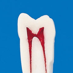    permanent endodontic teeth practce