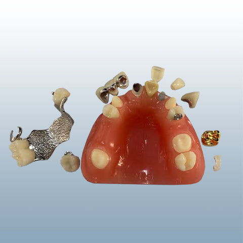 dental ceka attachment restoration model