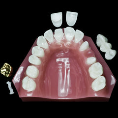 dental-restoration-model