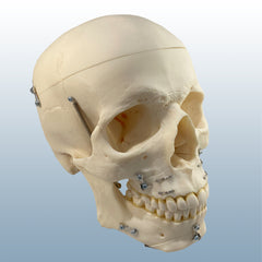surgical skull osteo model