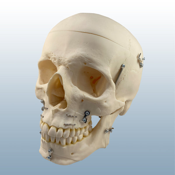 skull surgical model osteo