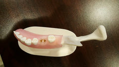 dental socket grafting model