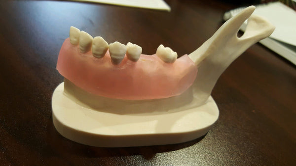 dental socket grafting model